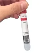 ACD+Gel tube ( 10 ml )